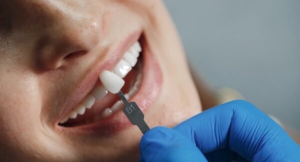 Las 10 mejores clínicas en implantes dentales de CDMX