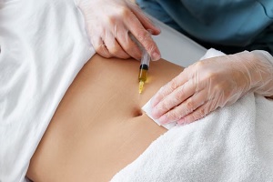 Carboxiterapia