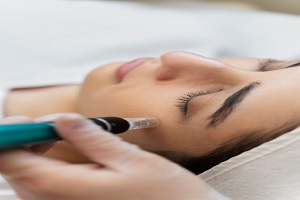 Mesoterapia-facial-o-corporal
