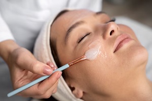 Peeling-quimico